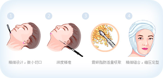 有什么方法可以瘦脸？