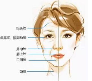 北京美天botox去皱