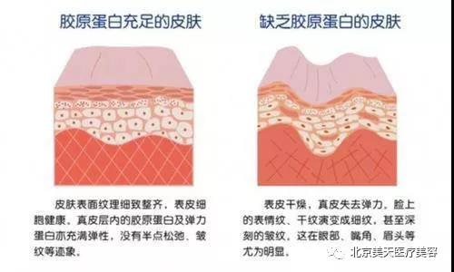 胶原蛋白示意图